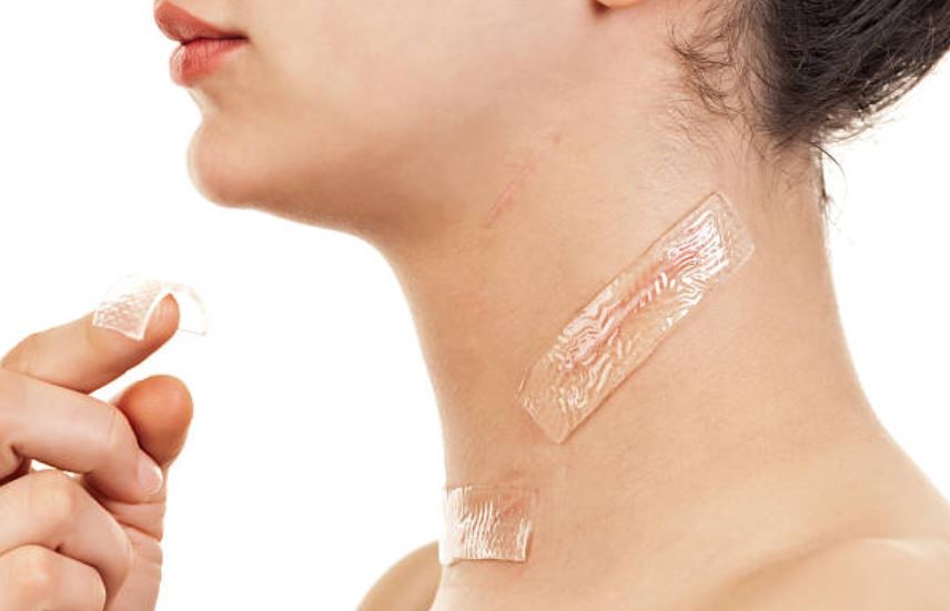 parches reductores de cicatrices