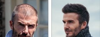 &iquest;Se est&aacute; quedando calvo como una pelota el bello David Beckham?