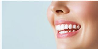 Blanqueamiento dental