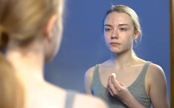 Cómo cuidar la piel en la adolescencia