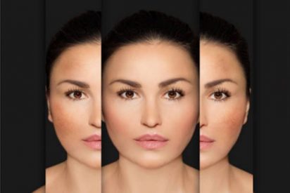 ¿Para qué sirve la arbutina?