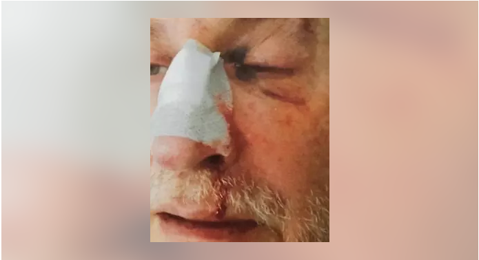 Un recluso agrede brutalmente a un funcionario de la prisi&oacute;n de Asturias