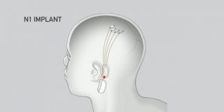 Neuralink, el proyecto de Elon Musk que conectar&aacute; el cerebro a un ordenador