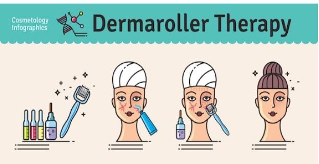 usar el derma roller o rodillo de microagujas