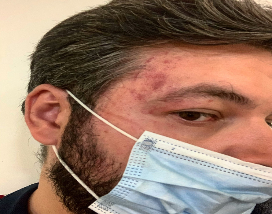 El jefe de prensa de Vox Andaluc&iacute;a agredido por dos magreb&iacute;es en Sevilla