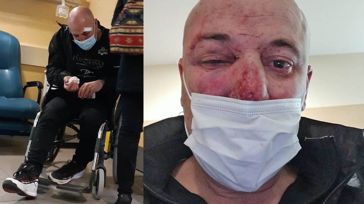 El paisano al que dieron una paliza dos polic&iacute;as en Linares declara como investigado por lesiones a los agentes
