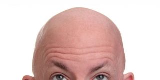 Cuidar una cabeza calva