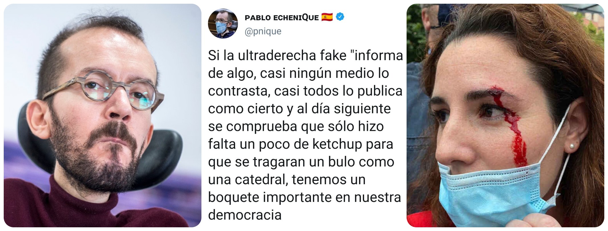 Echenique, que llamaba 'ketchup' a la sangre de la pedrada a De Meer, rabia contra VOX por decir que el ‘molotov’ a Podemos es un montaje