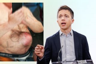 EXCLUSIVA / La v&iacute;ctima de &Iacute;&ntilde;igo Errej&oacute;n habla claro: "Lo peor fue el desprecio de la patada"