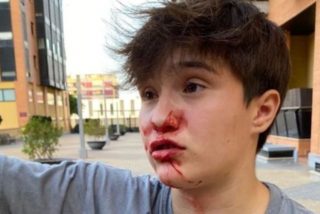 Agresi&oacute;n hom&oacute;foba en Alicante: rompen la nariz a una joven al grito de "maricona, transformer"