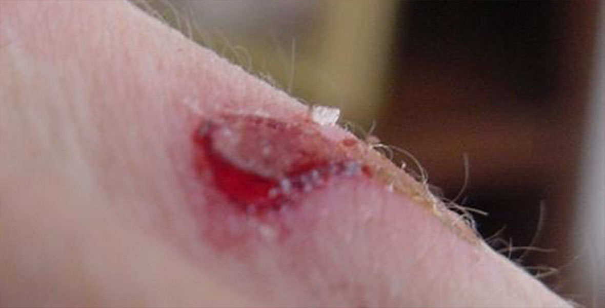 Realidades increíbles sobre fibras extrañas en nuestros cuerpos, nanotubos y otros inventos diabólicos para destruir a la humanidad