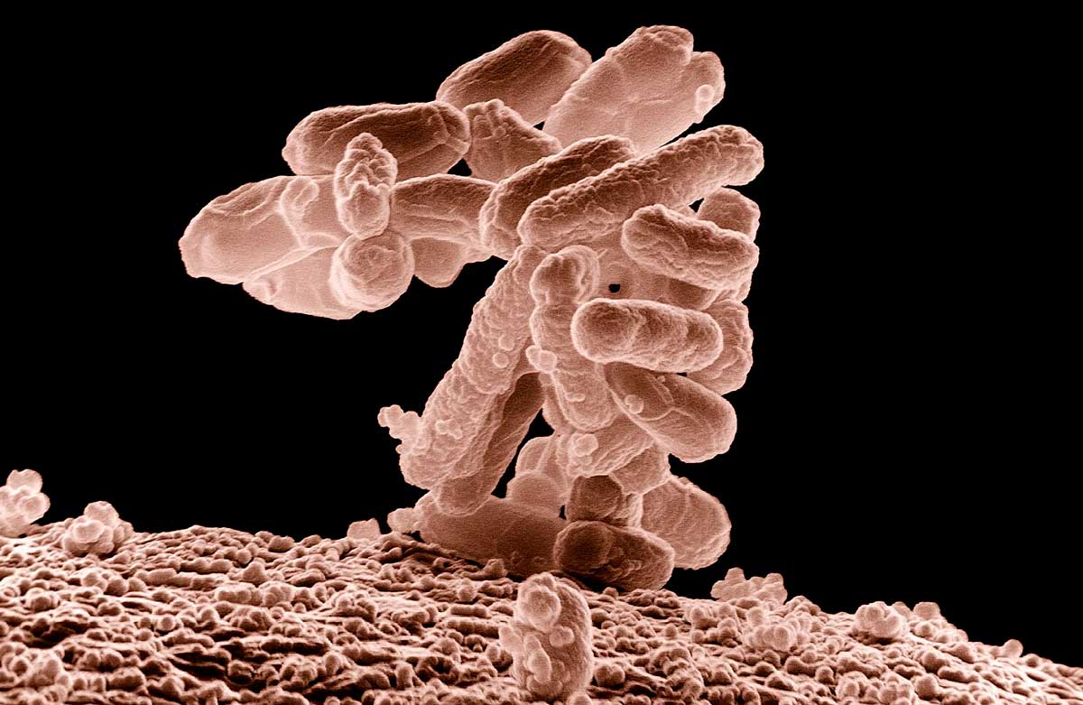 Descubren la causa del aumento de cáncer de colon en jóvenes: una bacteria silenciosa revoluciona el paradigma