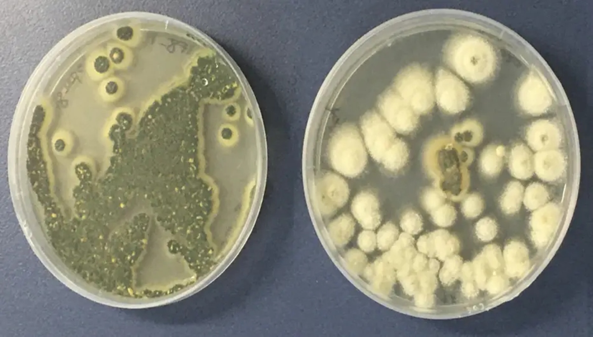 Aspergillus, el hongo letal