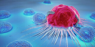 Cáncer, met&aacute;stasis y c&eacute;lulas cancerosas.
