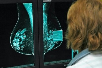 El cáncer y las mamografías