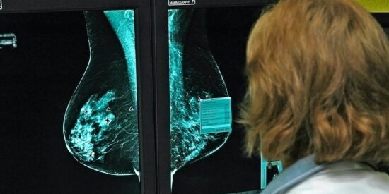 El cáncer y las mamografías