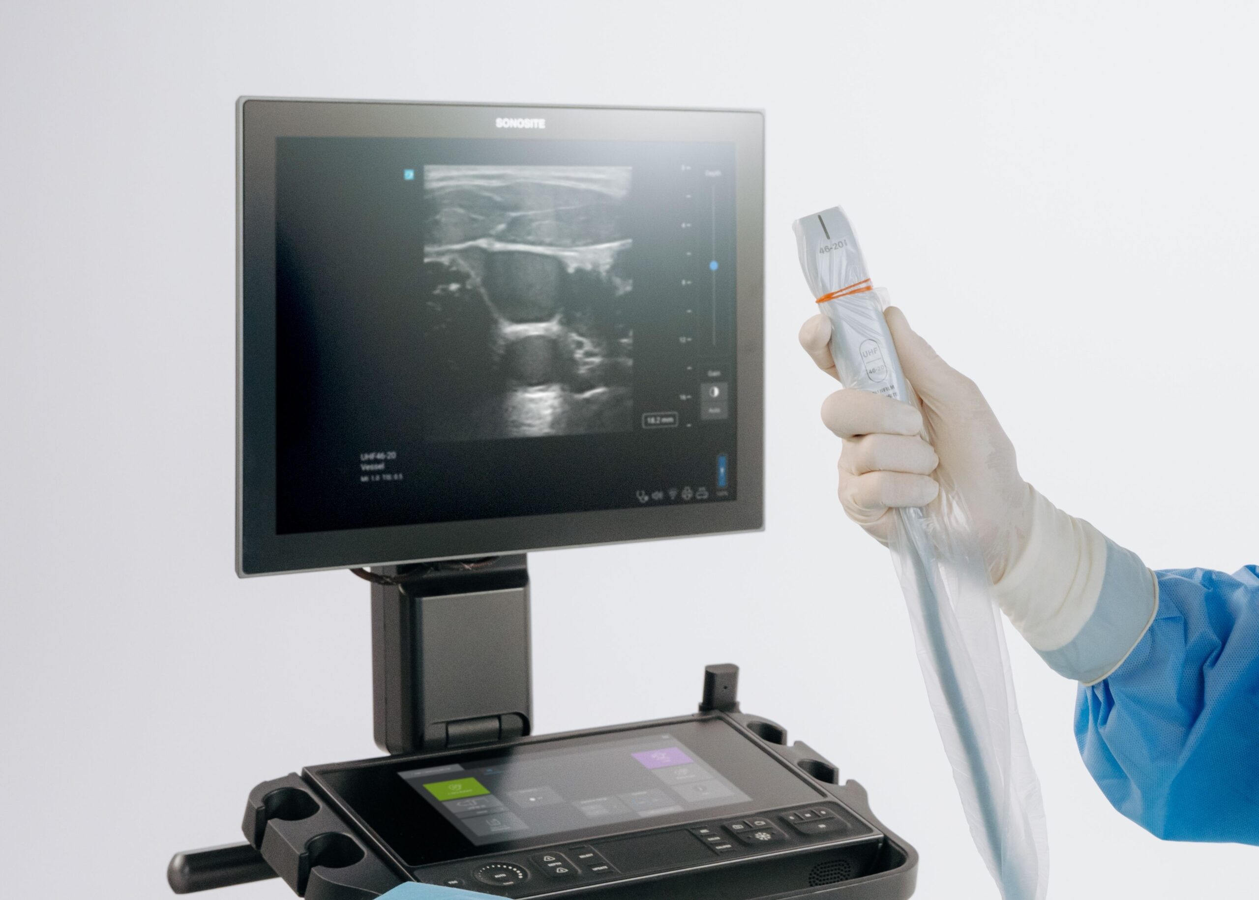Sonosite LX introduce la ultra-alta frecuencia en POCUS con el primer y &uacute;nico transductor de 46 MHz