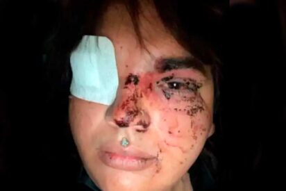 Salvaje agresi&oacute;n en Le&oacute;n: una decena de personas apalea a Miss Trans Zamora 2024