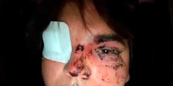 Salvaje agresi&oacute;n en Le&oacute;n: una decena de personas apalea a Miss Trans Zamora 2024