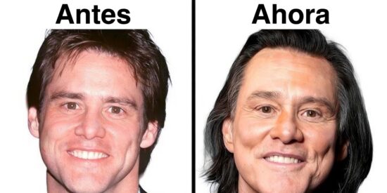 Jim Carrey.